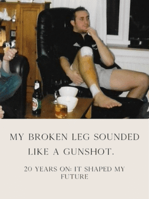 Broken Leg